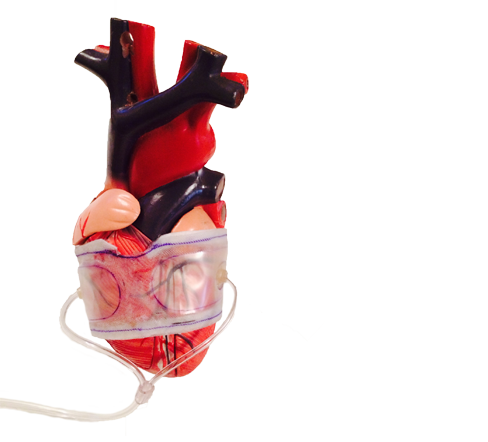 eHeart